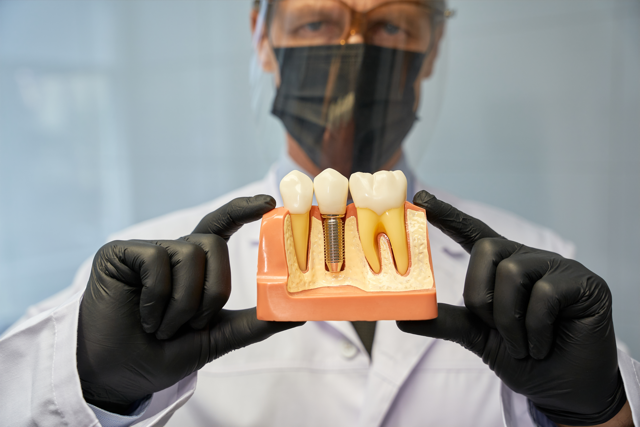 Cosmetic Smile Makeover