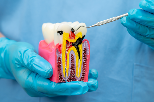 Cosmetic Smile Makeover